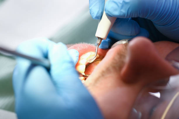 Best Emergency Treatment for Toothache in Parma, OH